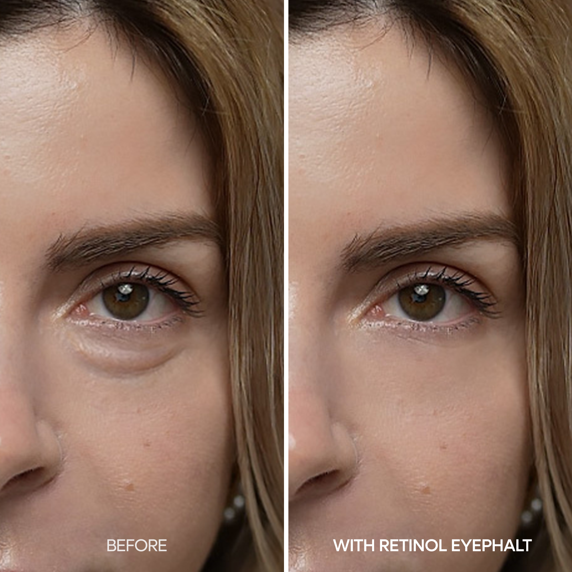 Retinol Eyebag Cream - image 4